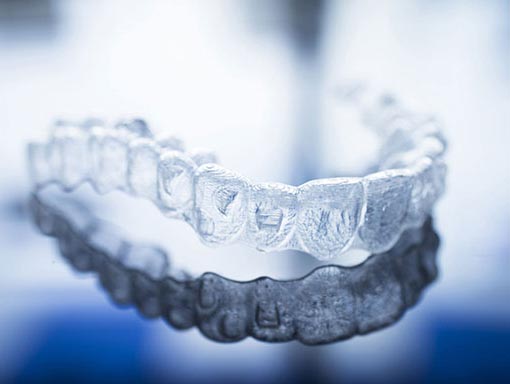 clear teeth aligners