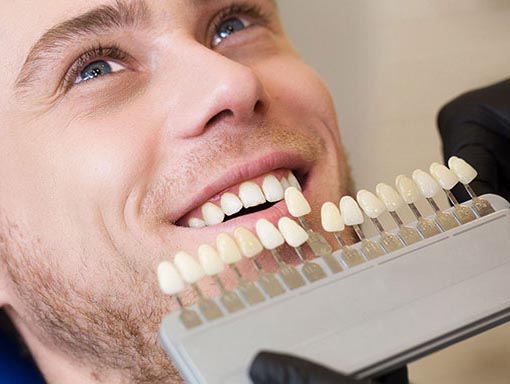 man receiving porcelain veneers options