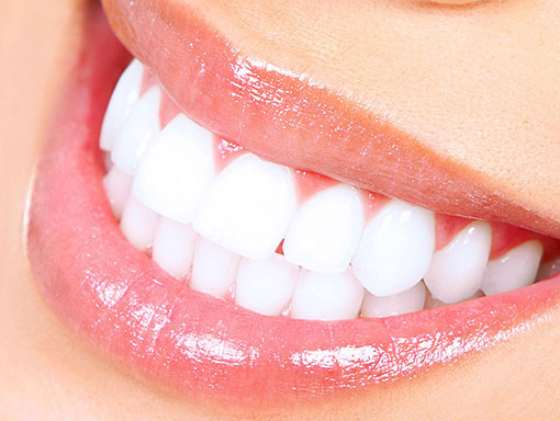 white teeth smiling